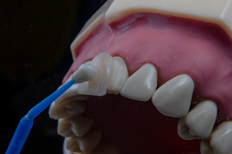 Photo dental implant process