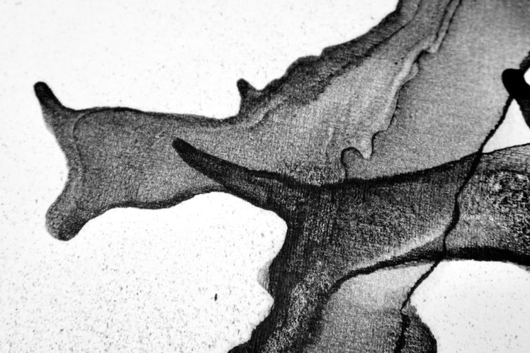 Photo temporomandibular joint disorder