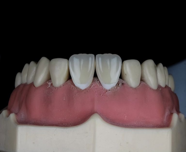 Photo dental flossing