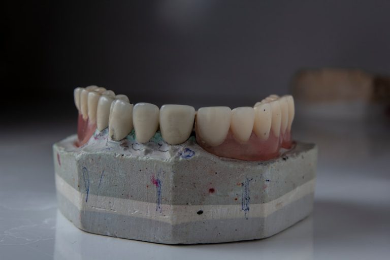Photo dental sealants