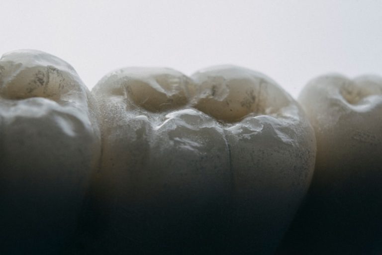 Photo tooth replacement schedule